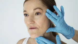 Aplicación de Radiesse en Weston Florida para lifting facial y bioestimulación con resultados naturales y firmes