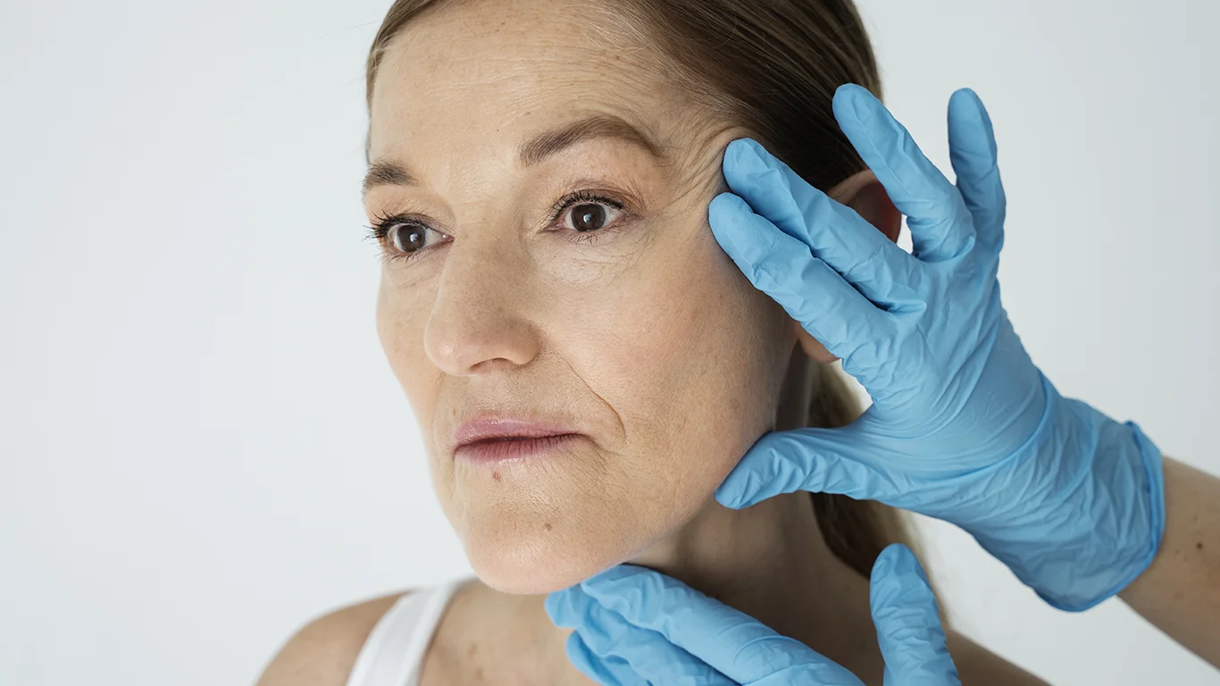 Aplicación de Radiesse en Weston Florida para lifting facial y bioestimulación con resultados naturales y firmes