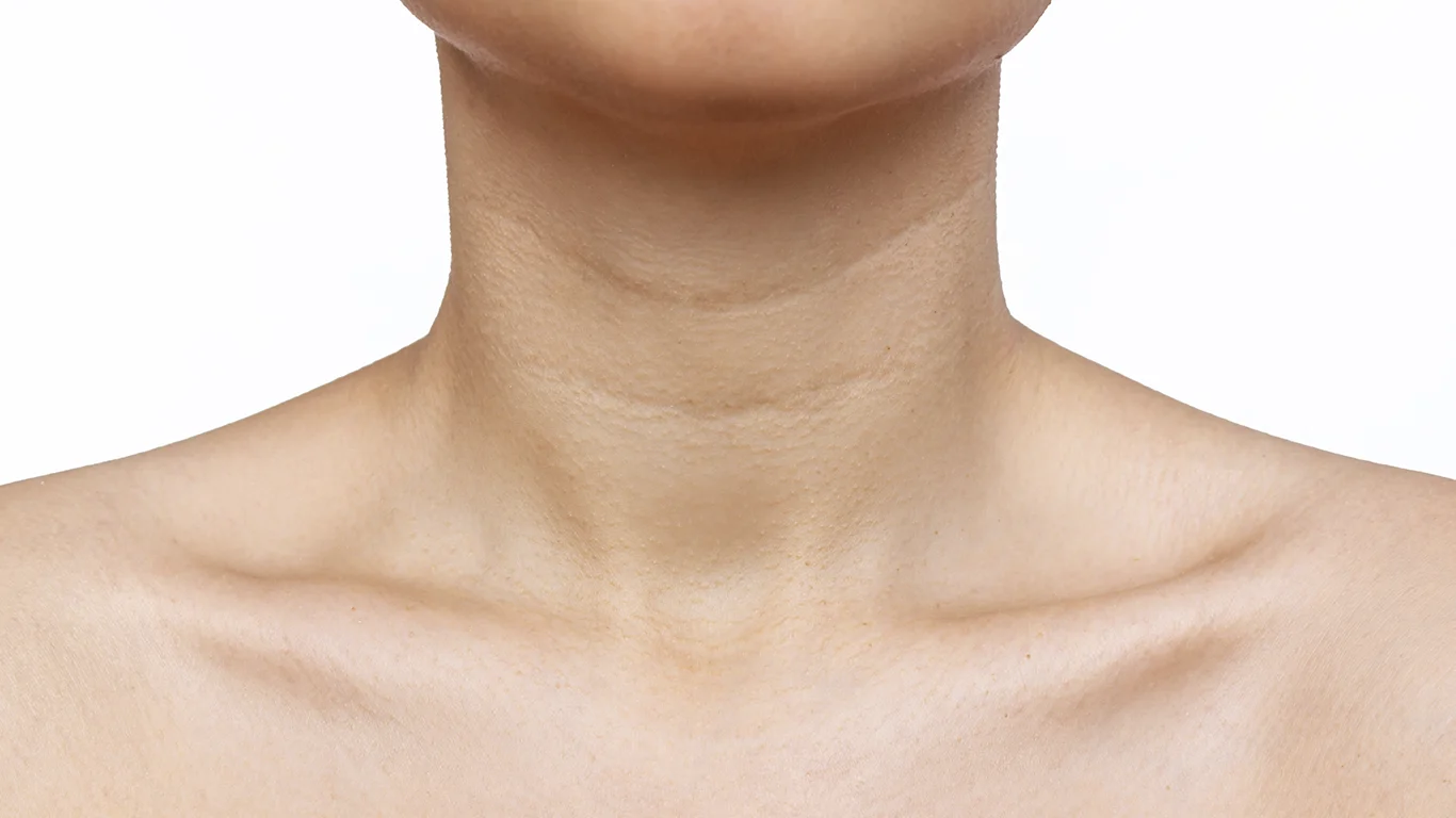 Tratamiento de tech neck en Weston Florida para mejorar líneas del cuello, flacidez y papada con tecnología avanzada