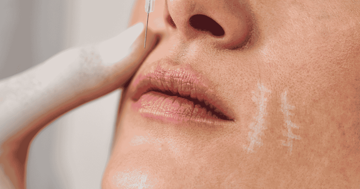 El término armonización facial o facial balancing (a veces llamado también facial harmonization) se refiere a evaluar el rostro como un todo, observando cómo se relacionan la frente, la nariz, las mejillas, los labios y el mentón entre sí.