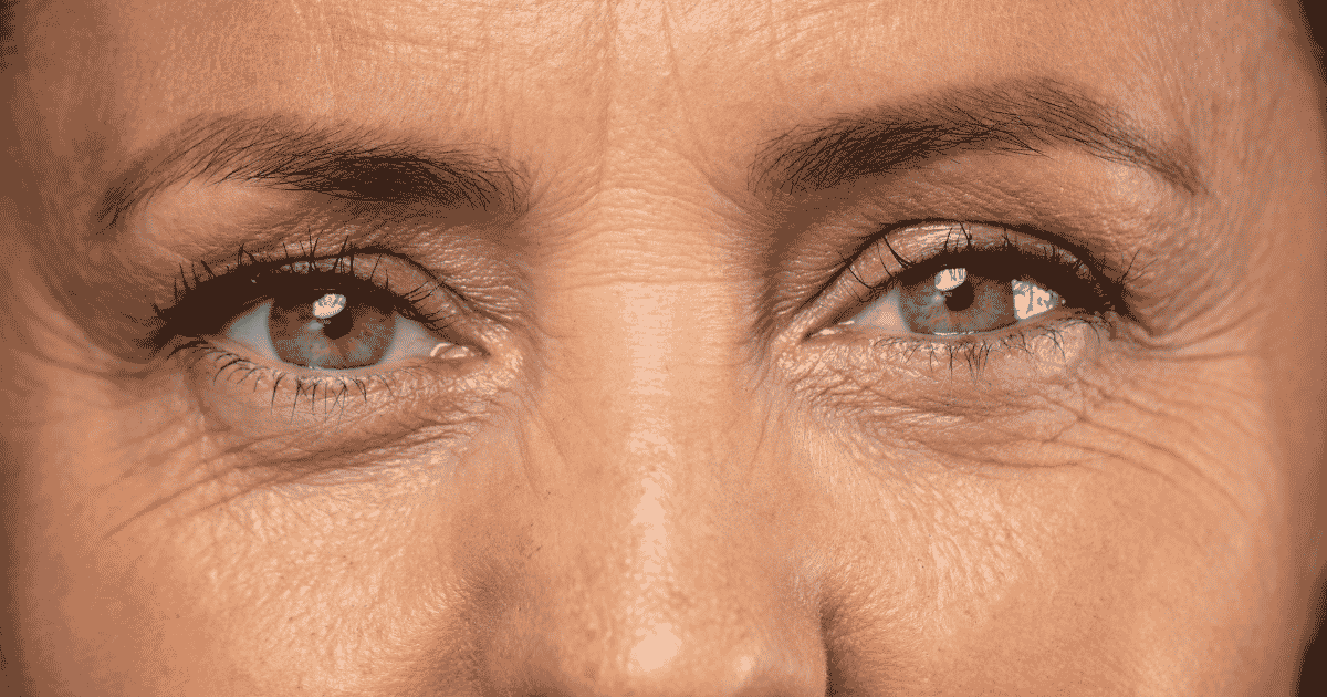 ¿Piel suelta en los párpados? Conoce la blefaroplastia sin cirugía con láser Erbium en Glow Up Weston con Alejandra Díaz.